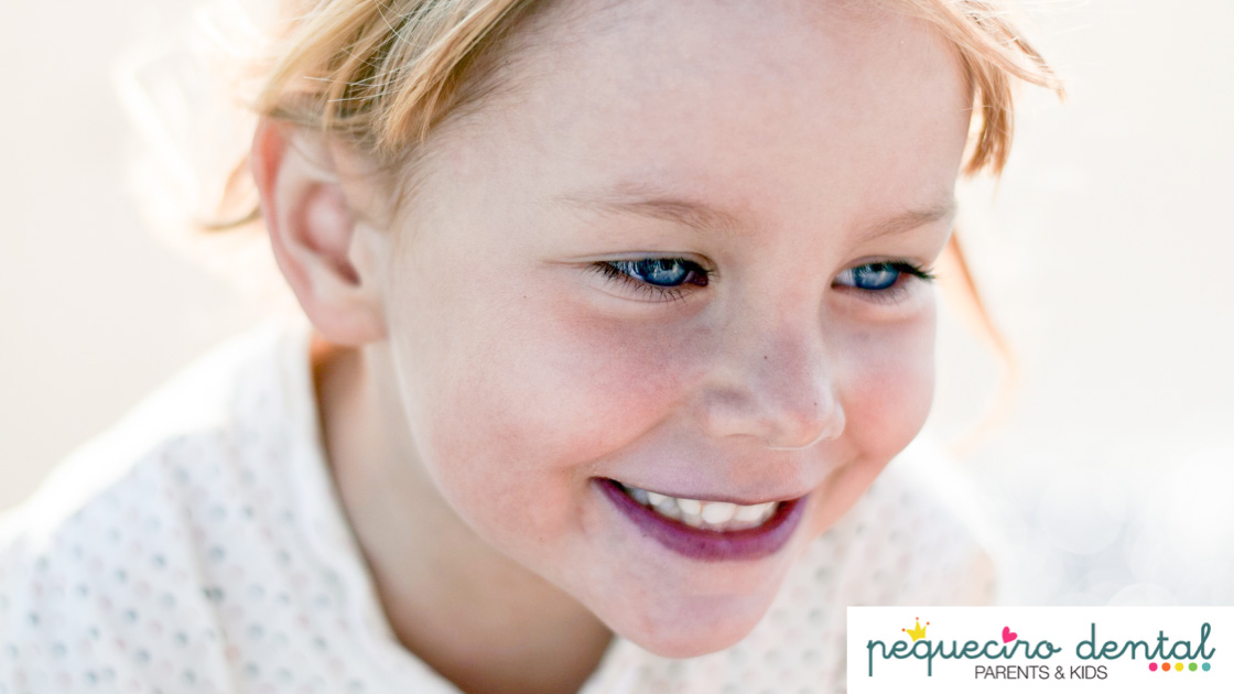 hipoplasia-manchas-blancas-ninos-pequeciro-CIRO-clinica-dental-Madrid-