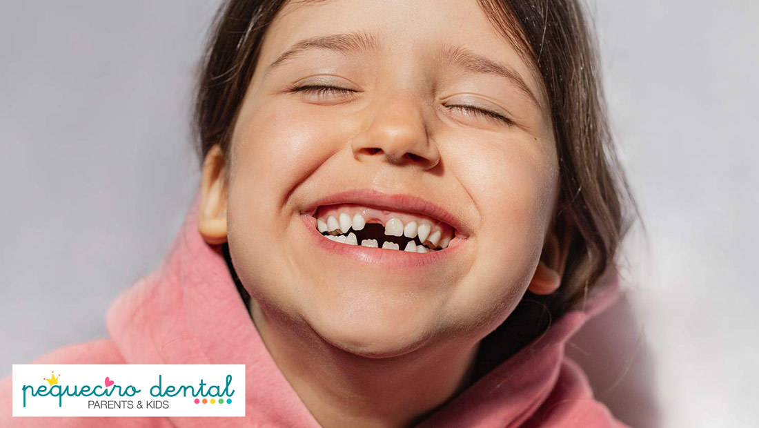 Cuándo se caen los dientes de leche