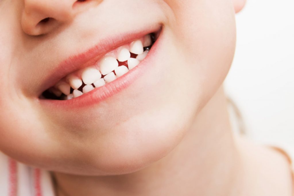 Cómo fortalecer el esmalte dental